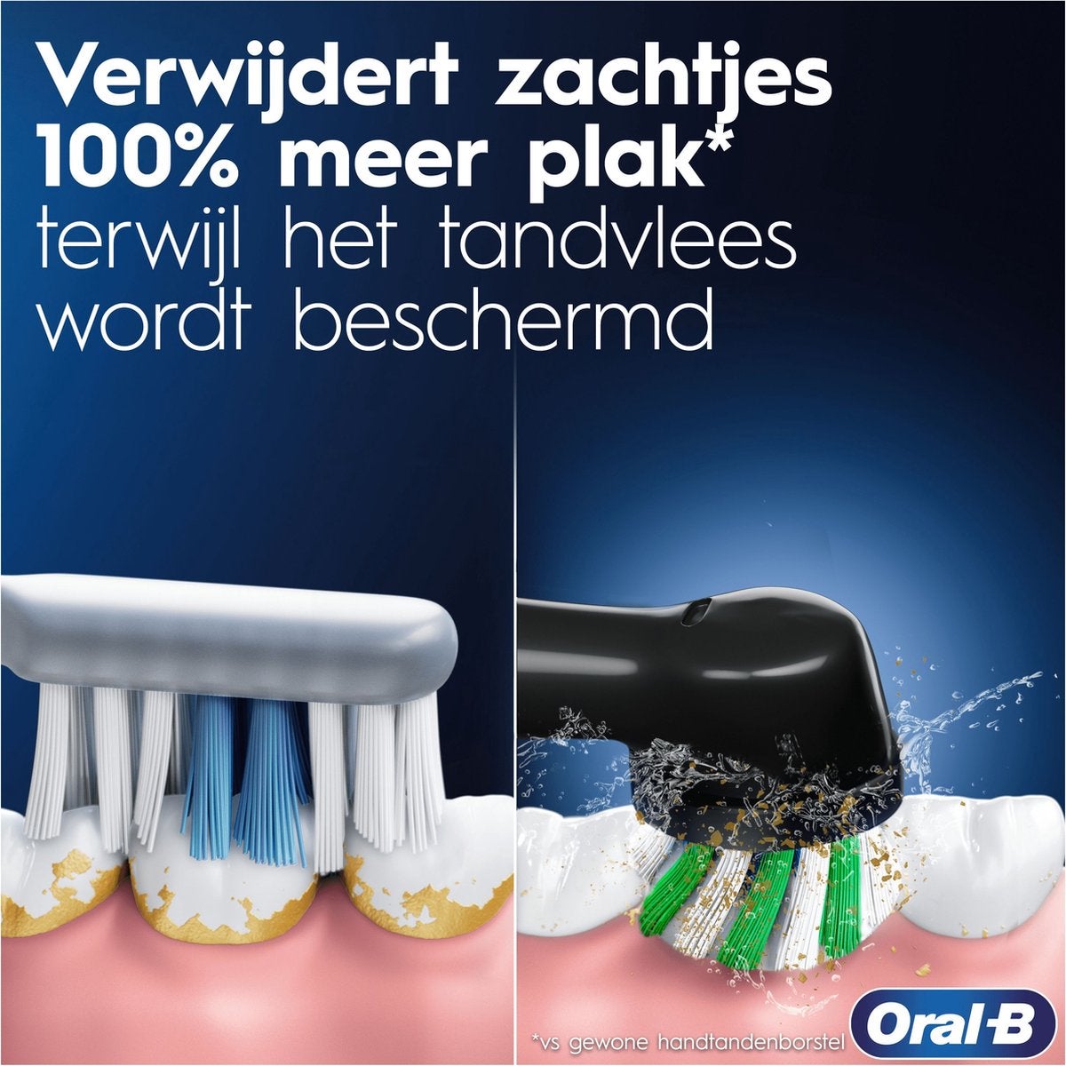 Oral-B Pro Series 1 Duo