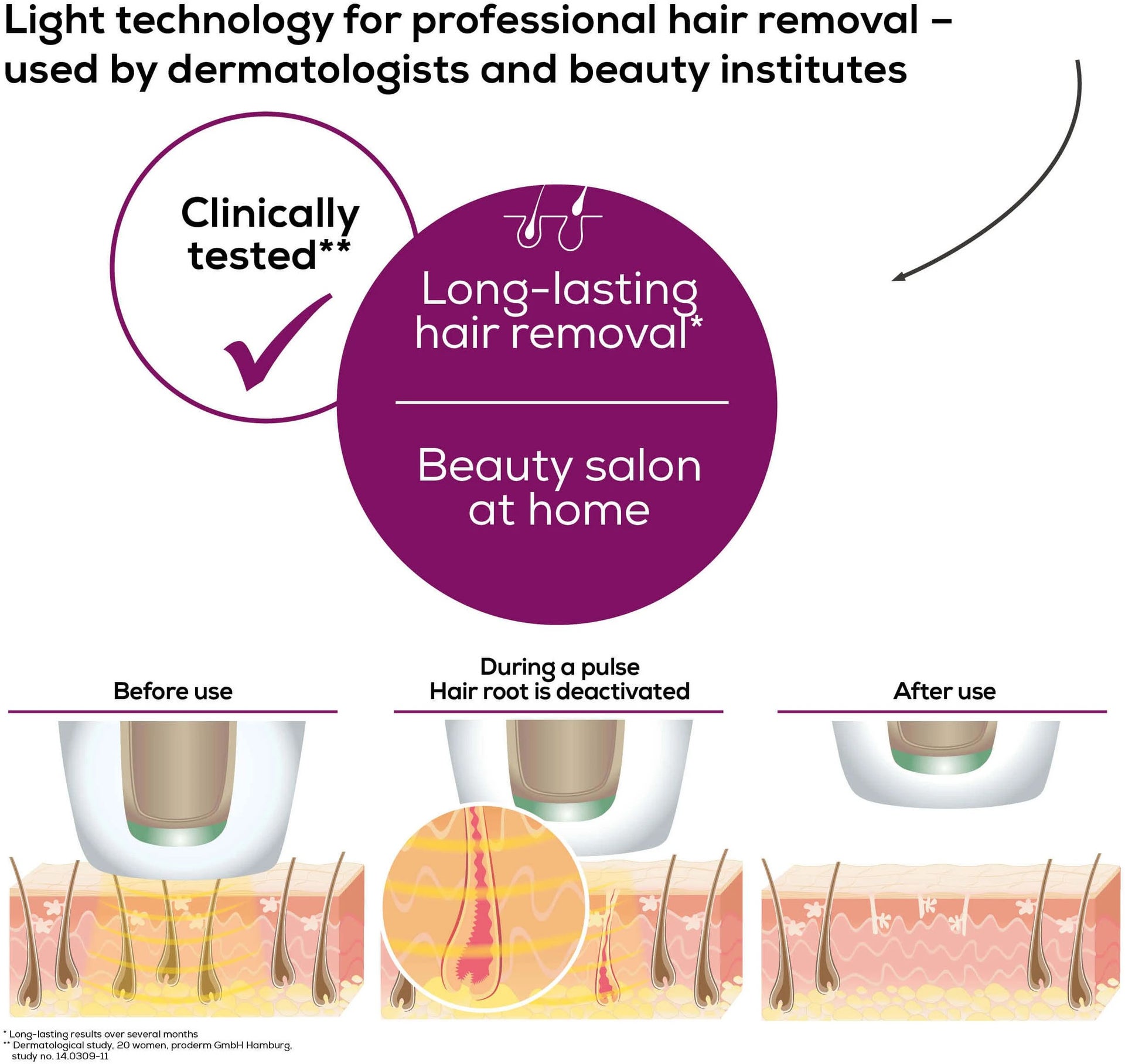 Beurer IPL PureSkinPro 5500